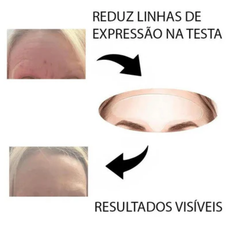 Adesivo Anti-Rugas das Famosas - Reutilizável em até 40 aplicações + Brinde Grátis